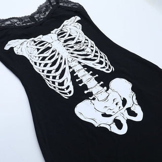 Lace hem v neck skeleton print cami mini dress